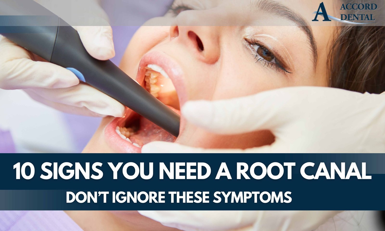 10 Signs You Need a Root Canal: Don’t Ignore These Symptoms