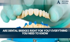 Are Dental Bridges Right For You? Everything You Need to Know