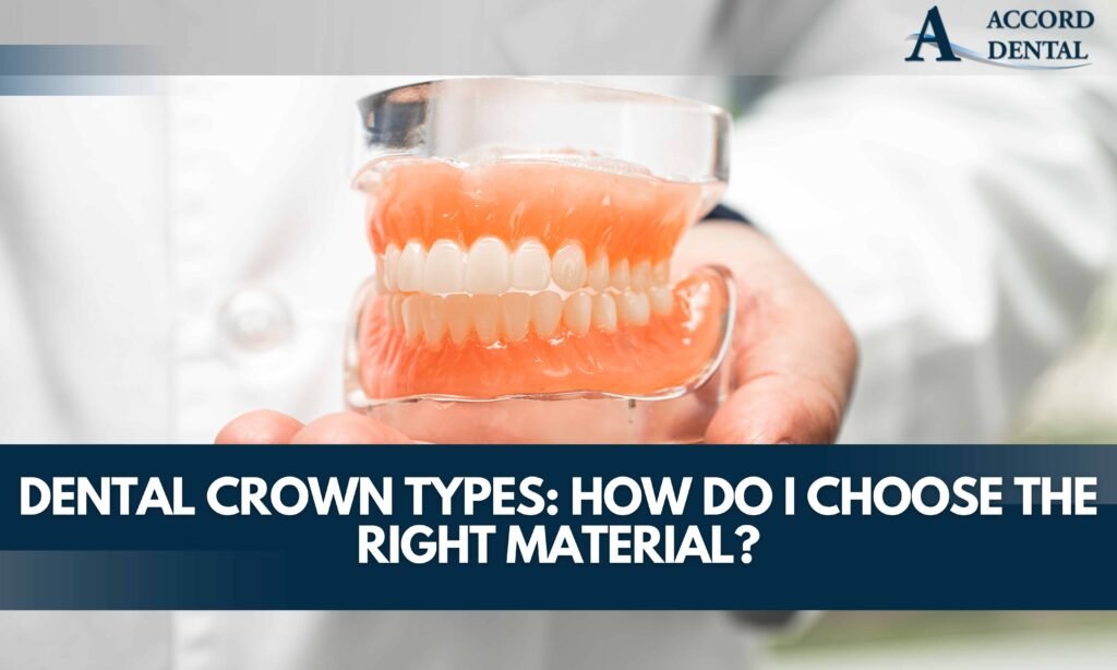 Dental Crown Types: How Do I Choose the Right Material?