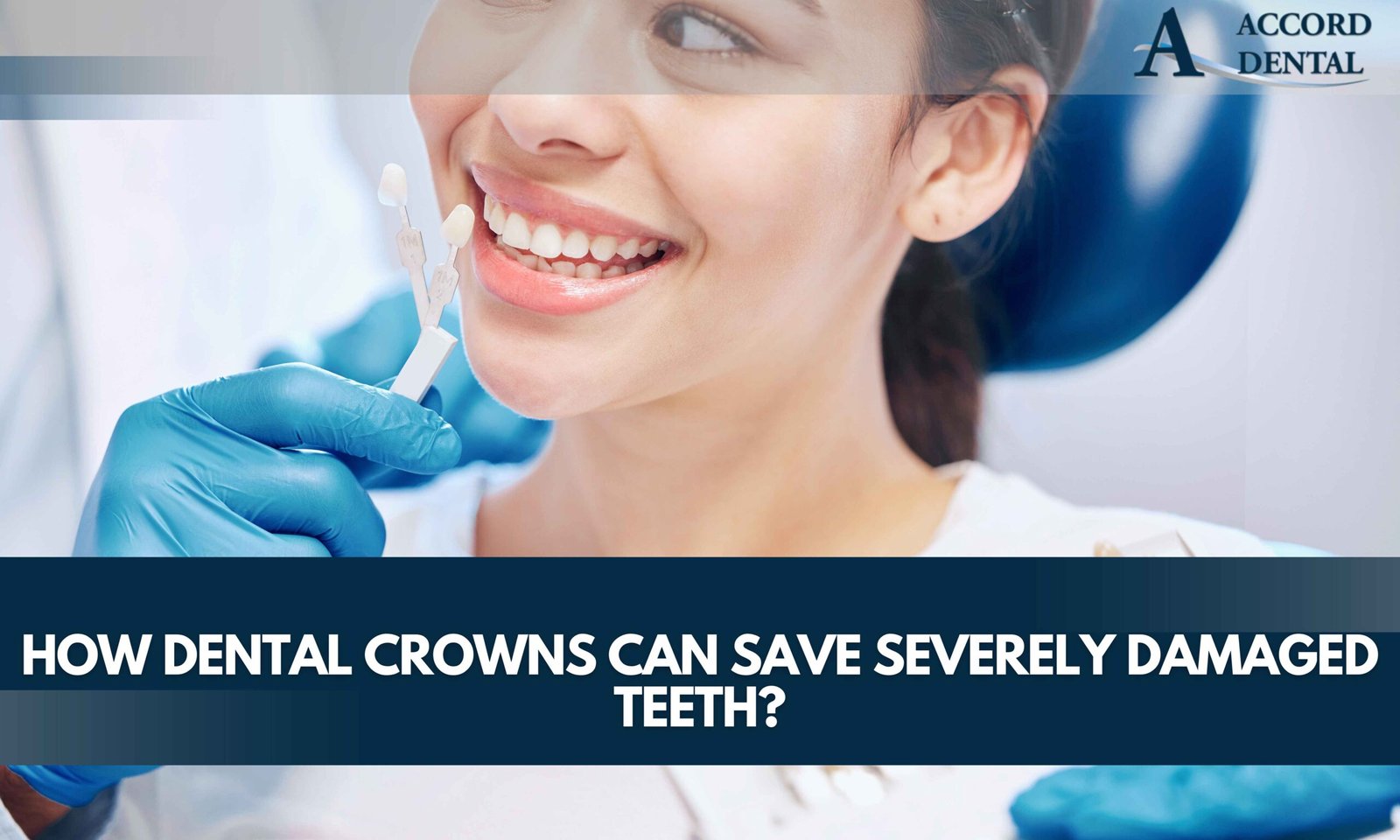 How Dental Crowns Can Save Severely Damaged Teeth?