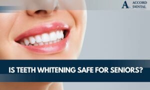 Is Teeth Whitening Safe for Seniors?