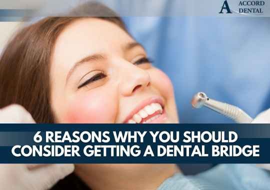 6 Reasons Why You Should Consider Getting a Dental Bridge