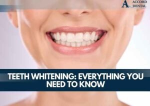 Teeth Whitening: Everything You Need to Know