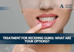 Treatment for Receding Gums: What Are Your Options?