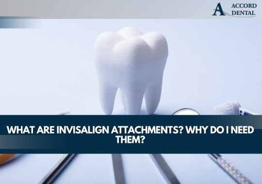 What Are Invisalign Attachments? Why Do I Need Them?