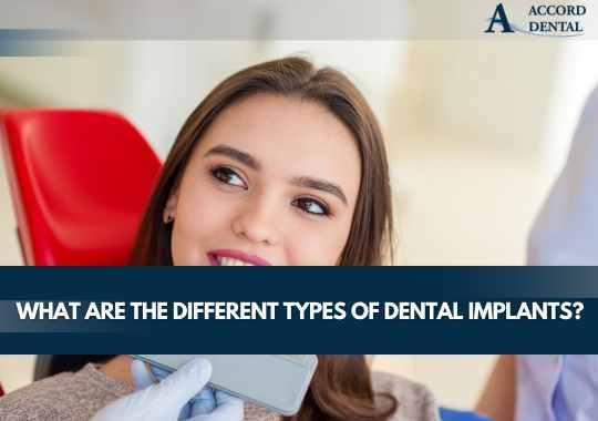 What Are the Different Types of Dental Implants?