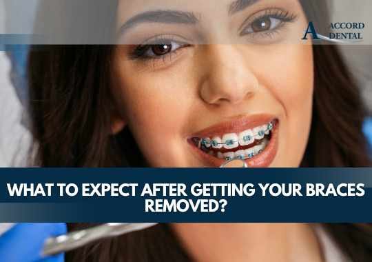 What to Expect After Getting Your Braces Removed?